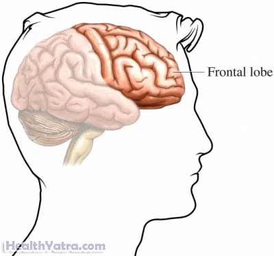 Conduct Disorder Symptoms, Causes, Treatment Cost in India – Update 2023 Conduct Disorder
